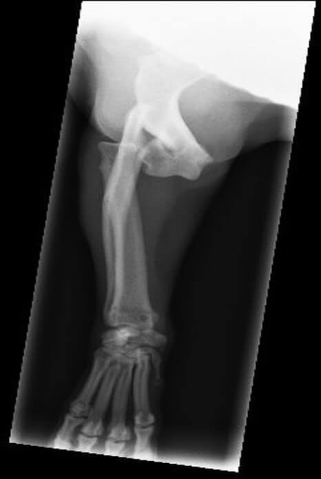 Traumatic Elbow Luxation